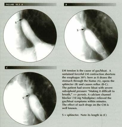 Click for larger image